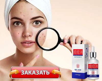 Сыворотка Bioaqua Anti Acne купить по доступной цене.